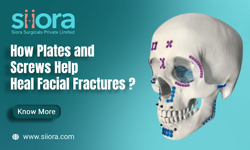 Maxillofacial Plates